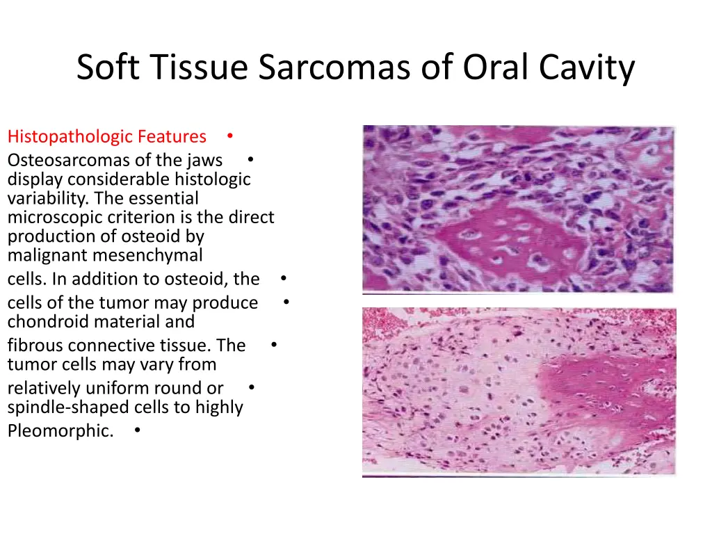 soft tissue sarcomas of oral cavity 7