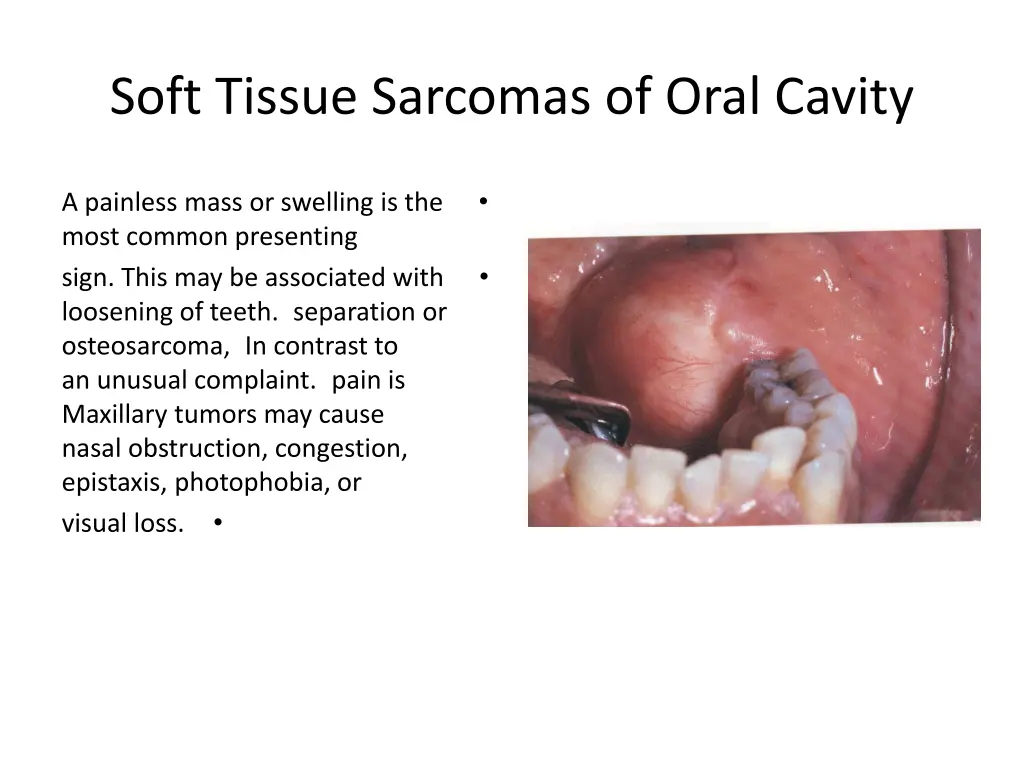 soft tissue sarcomas of oral cavity 9