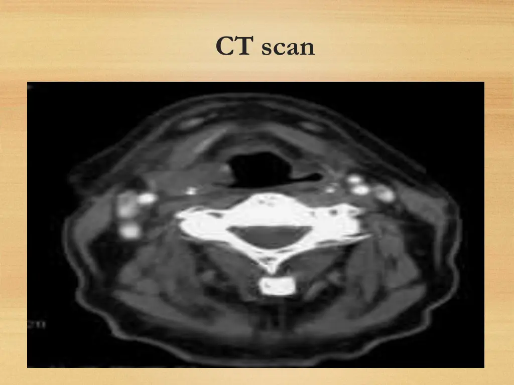 ct scan