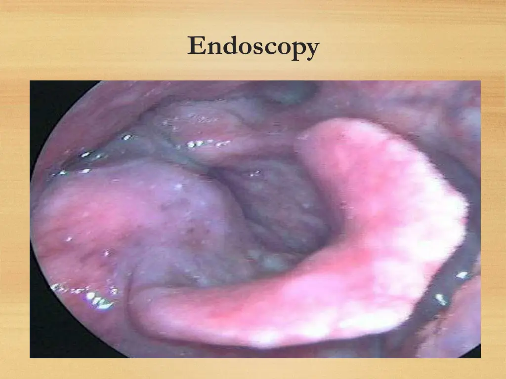 endoscopy