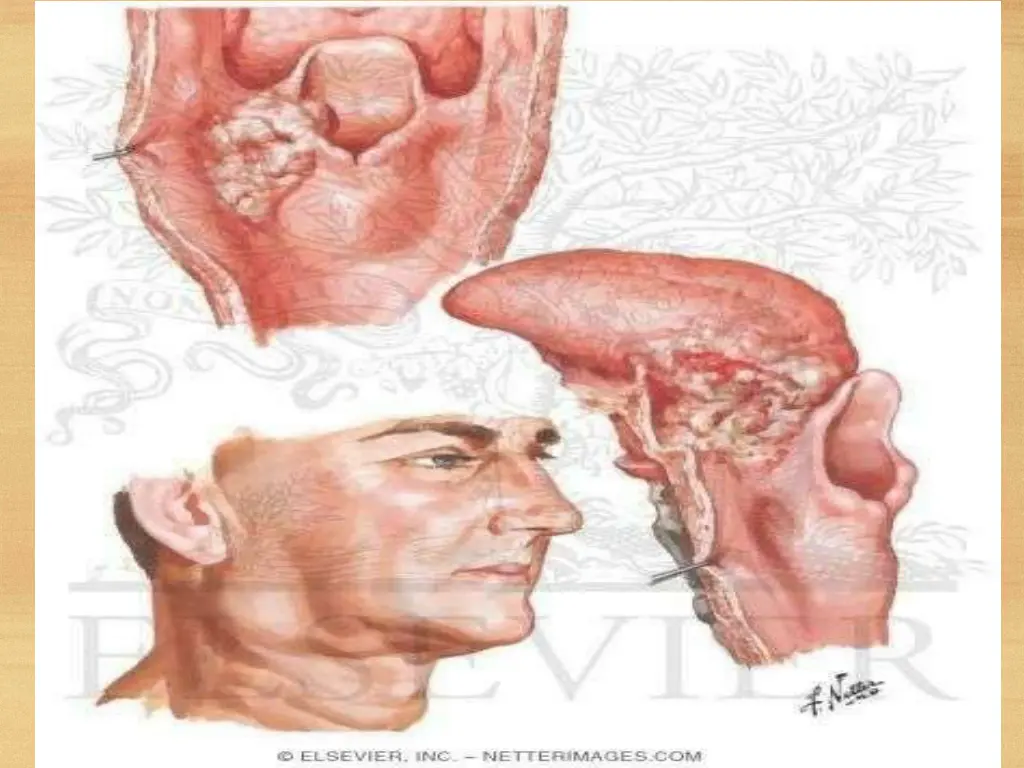 slide11