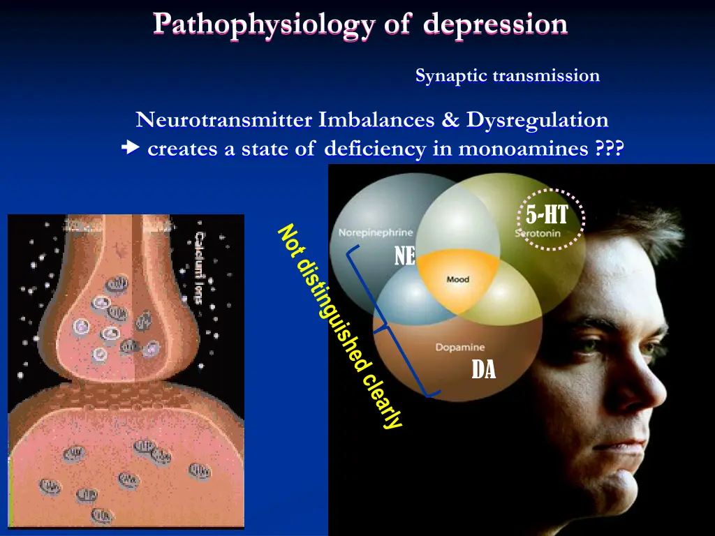 pathophysiology of depression