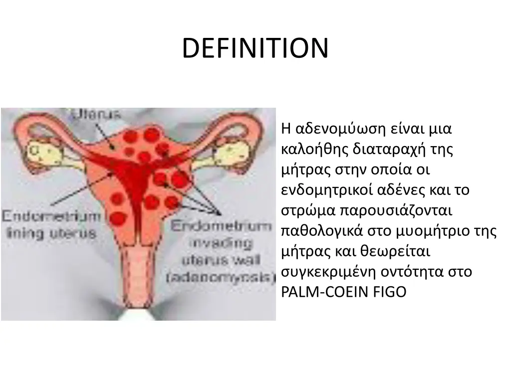 definition