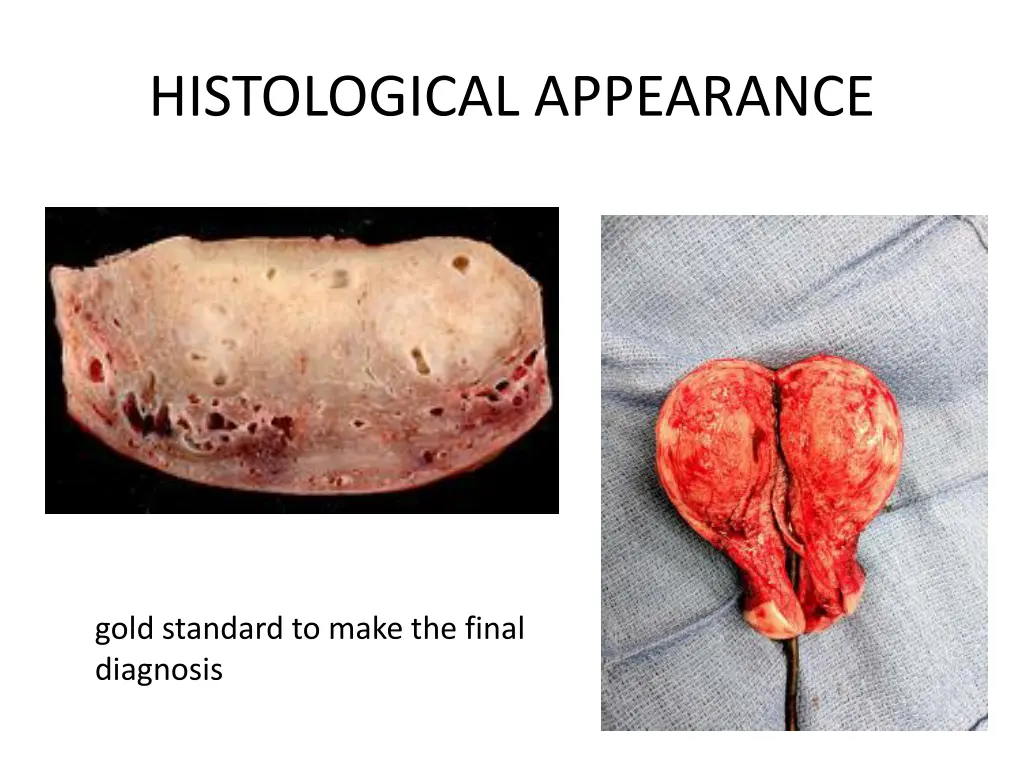 histological appearance