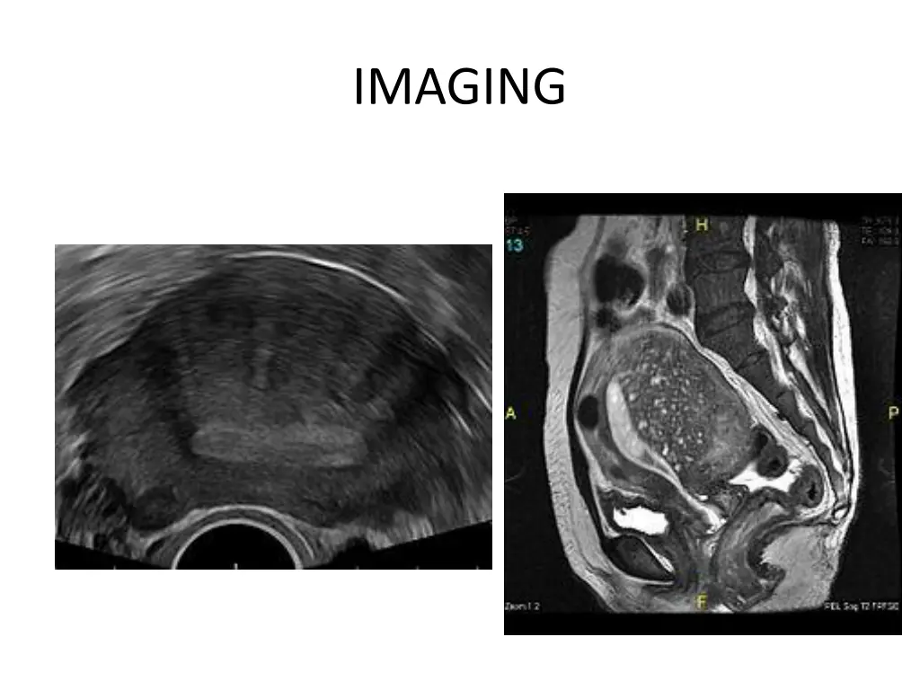 imaging