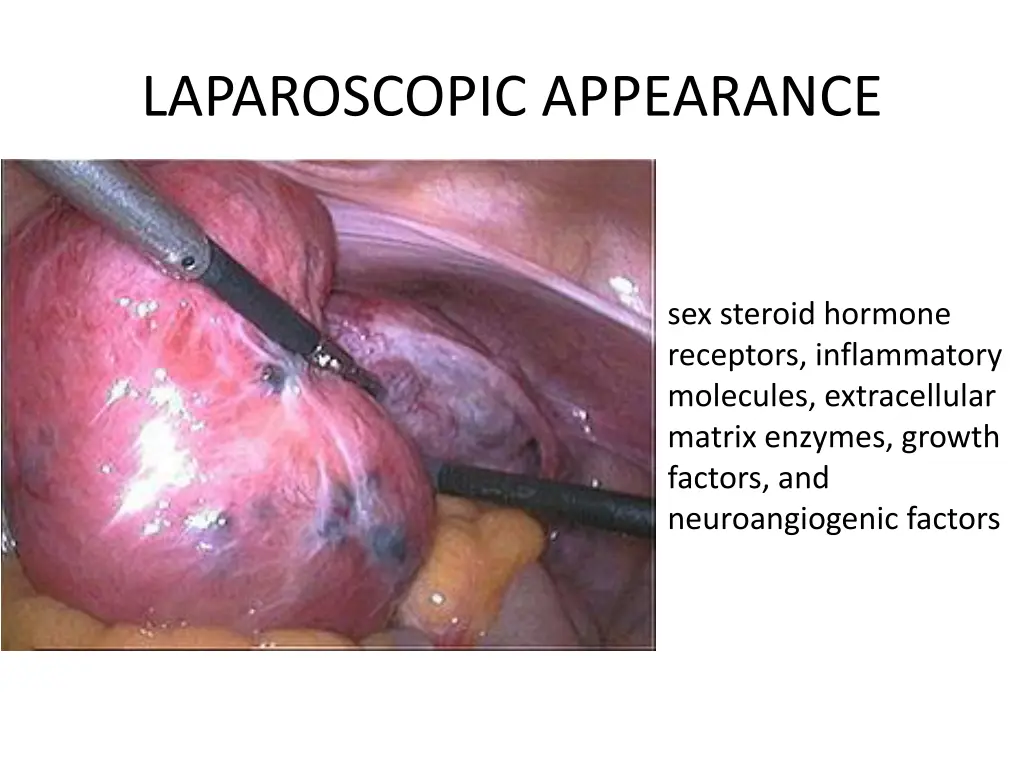 laparoscopic appearance