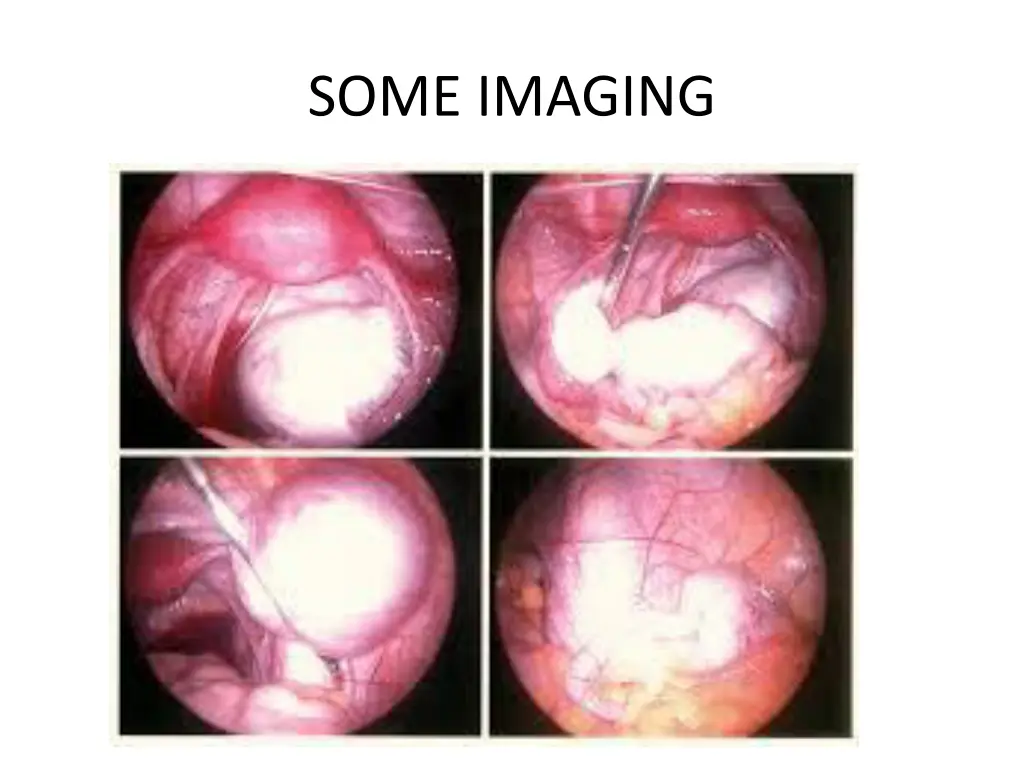 some imaging