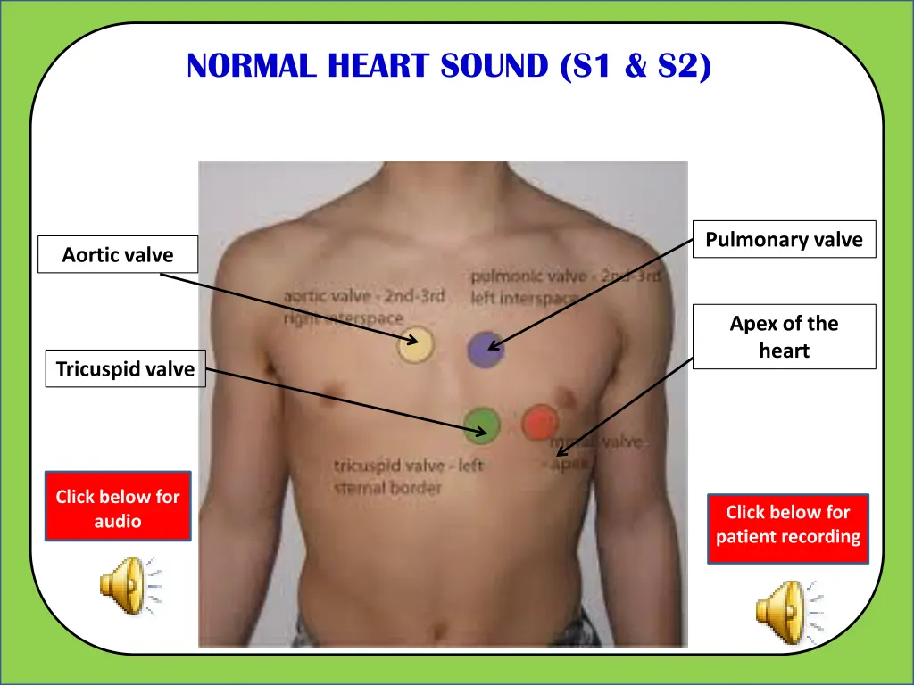 normal heart sound s1 s2 1