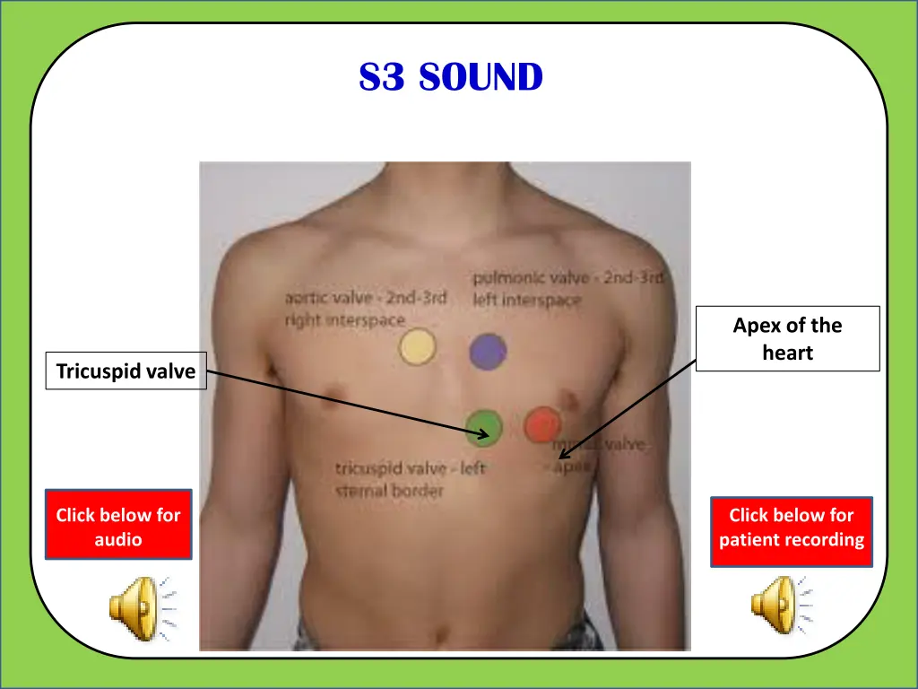 s3 sound 4