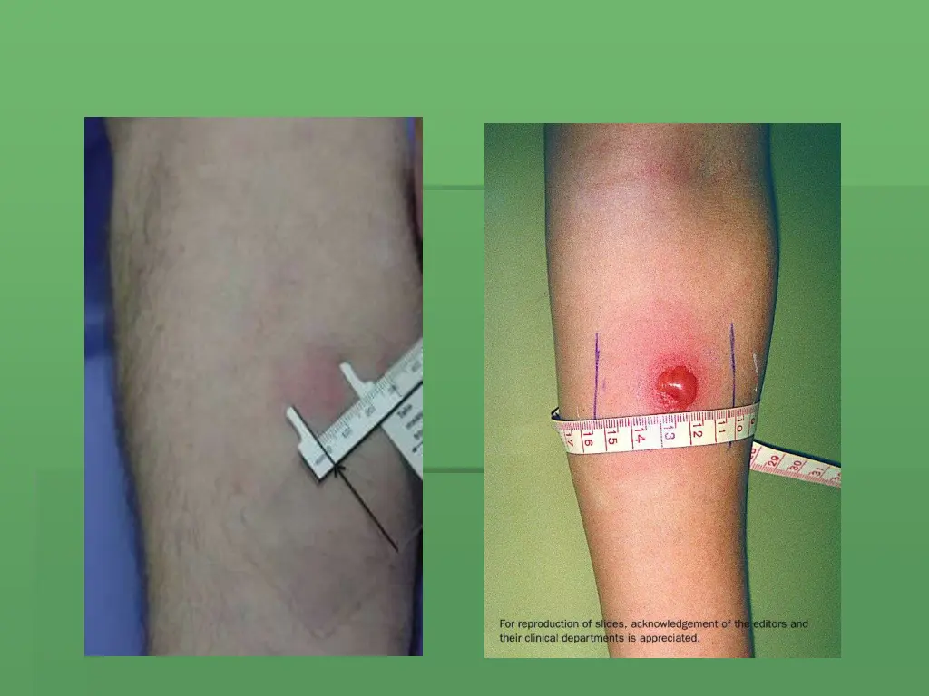 slide24