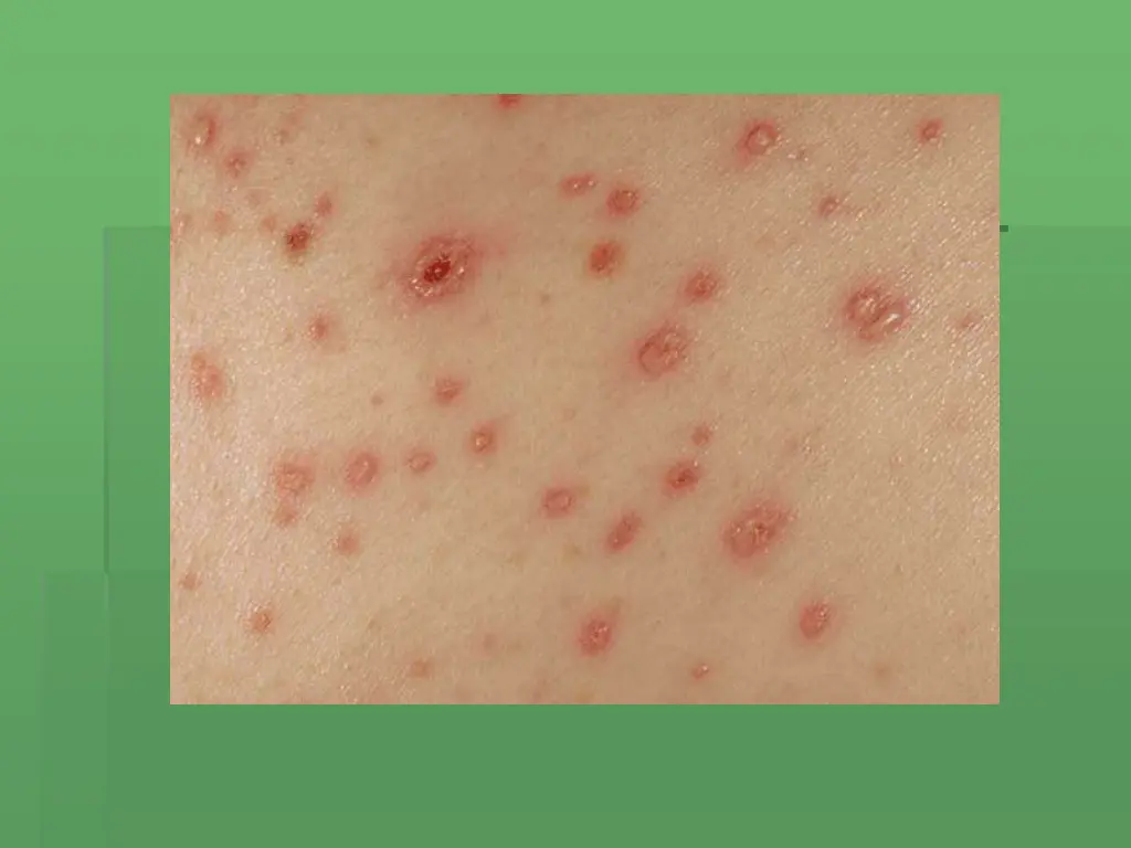 slide8
