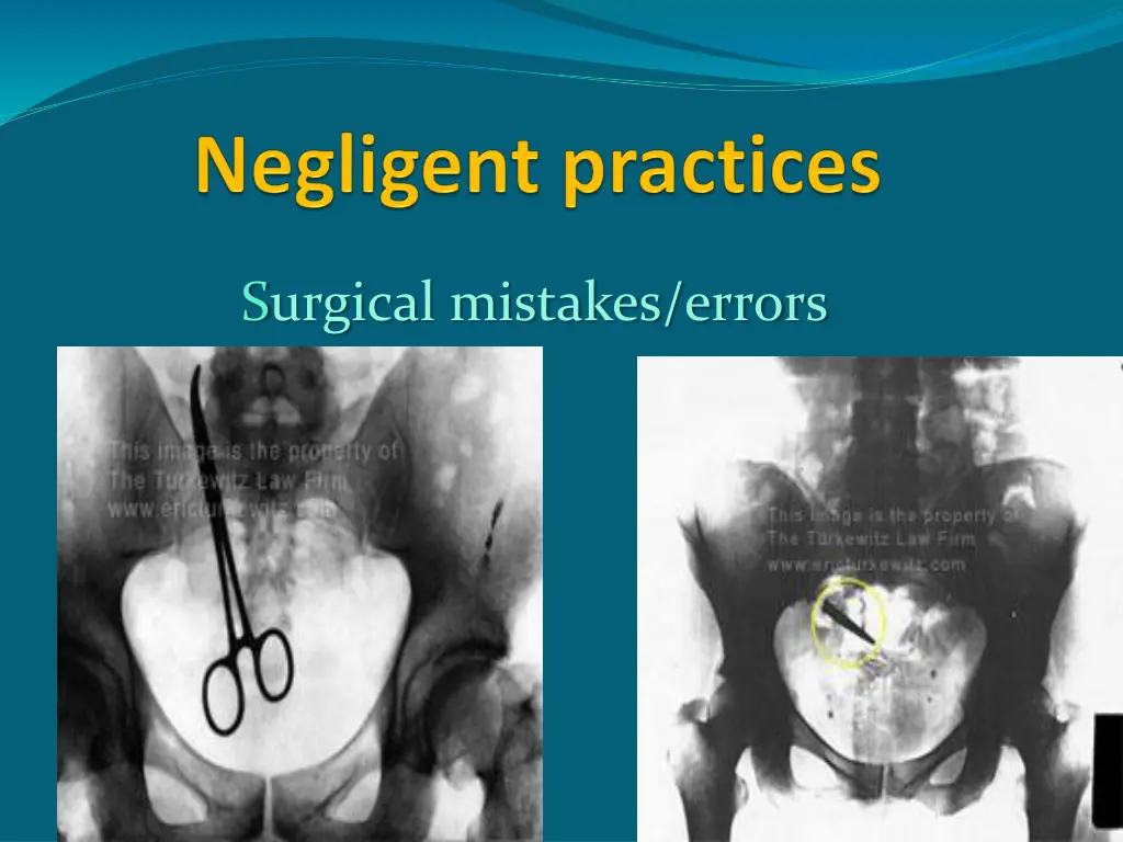 surgical mistakes errors