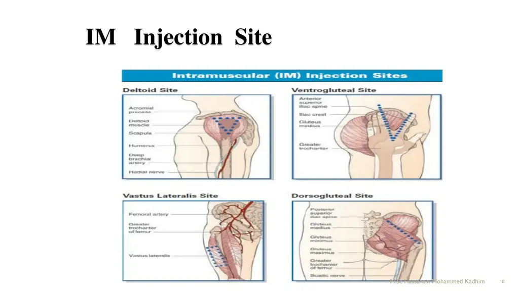 im injection site