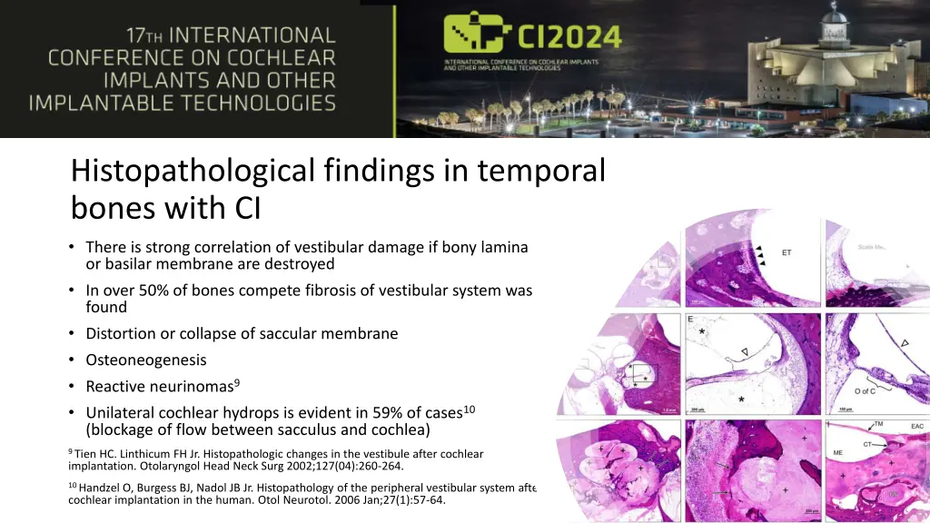 histopathological findings in temporal bones with
