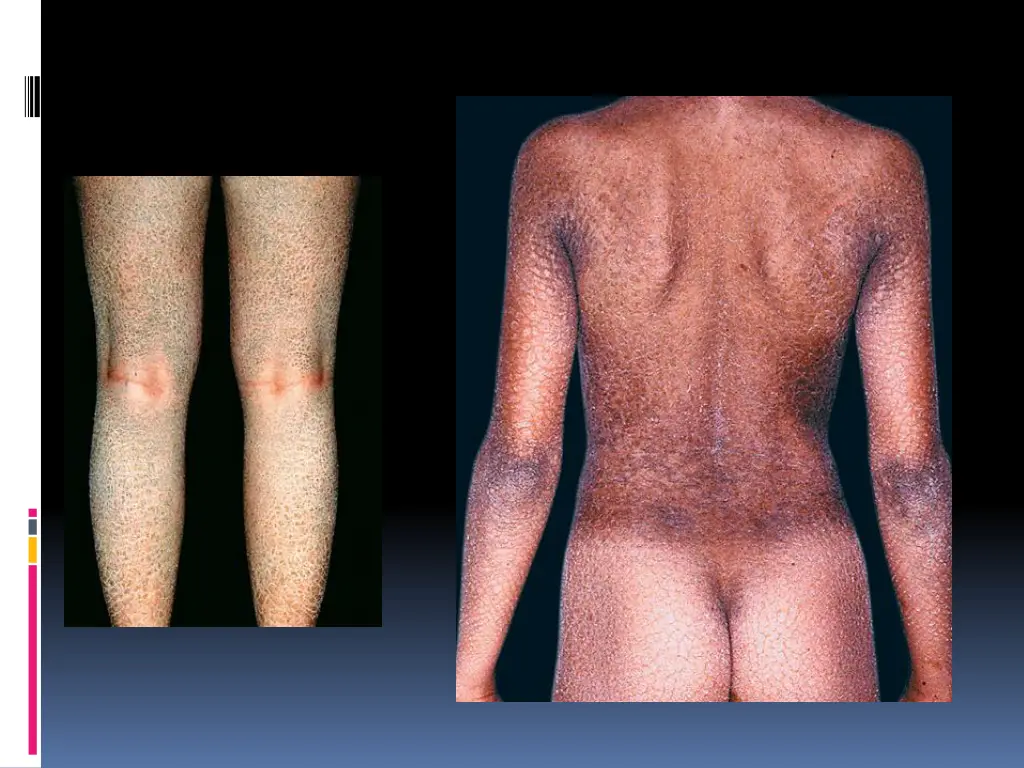 slide13