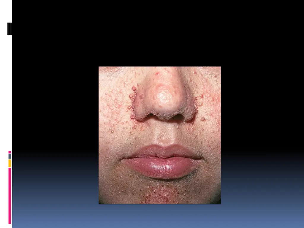 slide6