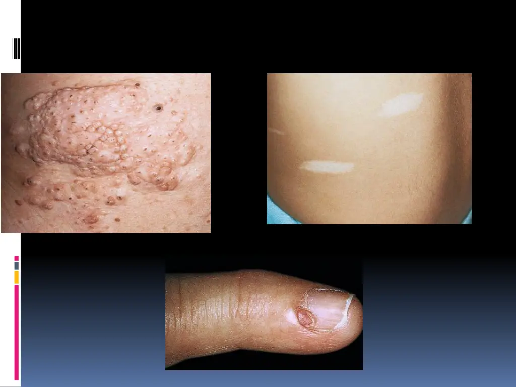 slide7