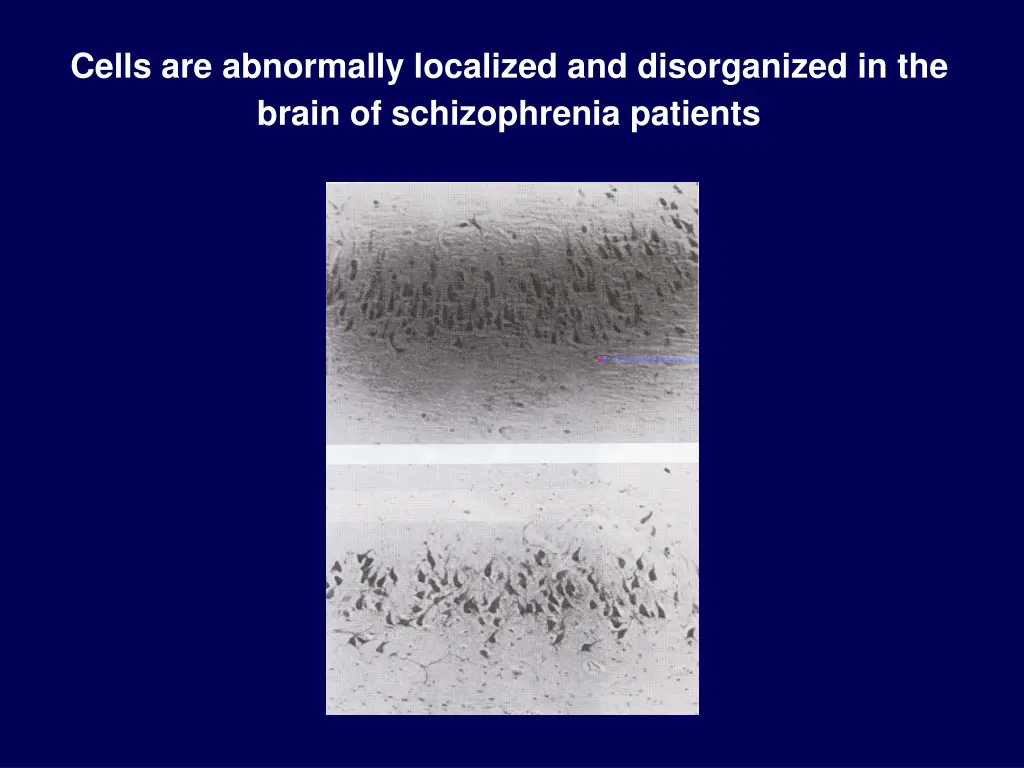 cells are abnormally localized and disorganized