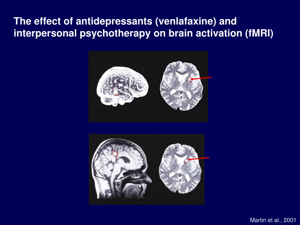 the effect of antidepressants venlafaxine