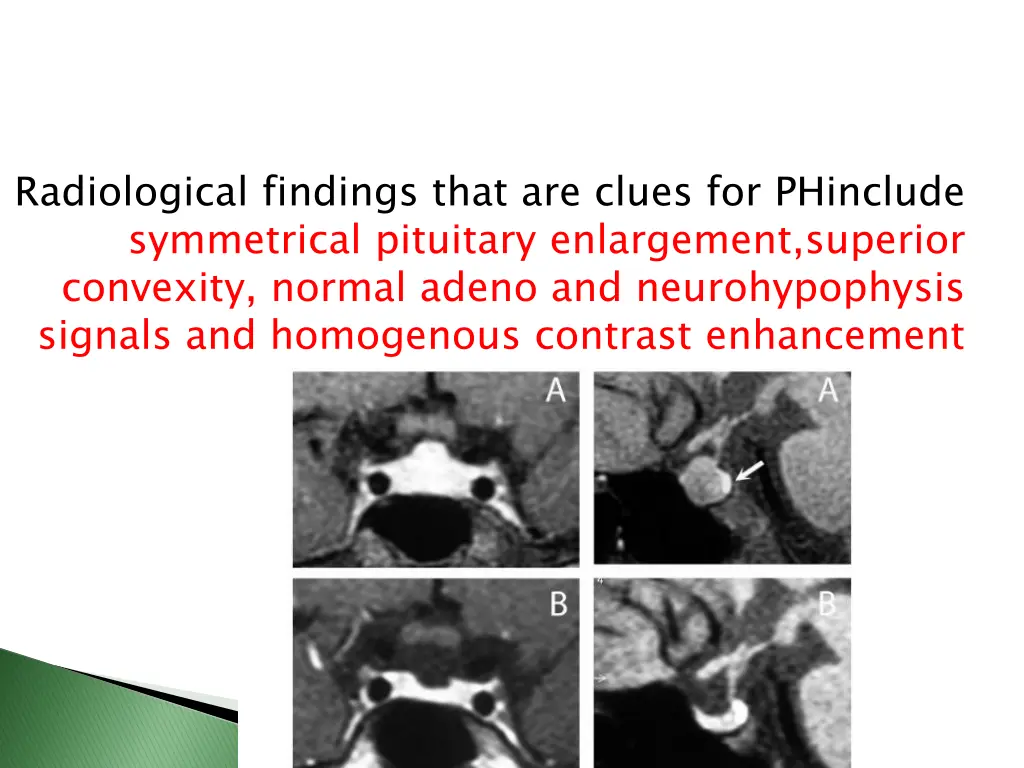 radiological findings that are clues