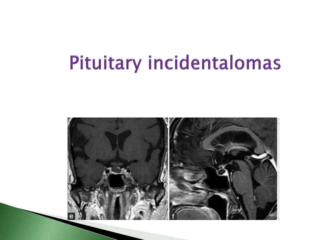 slide2