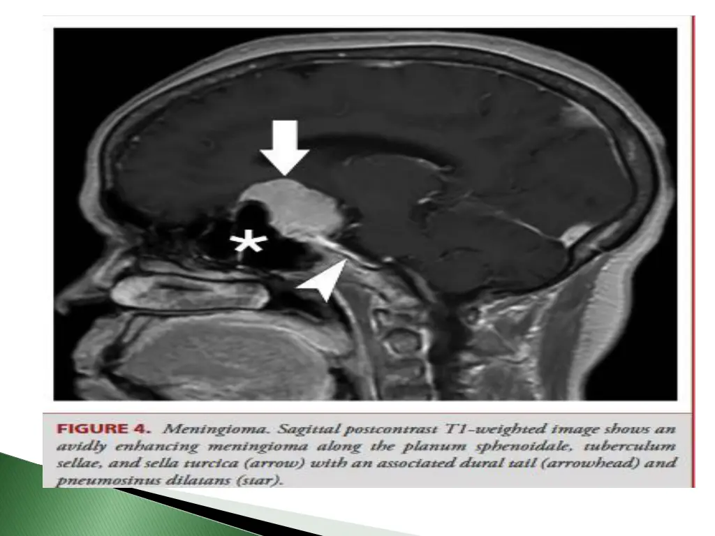 slide38