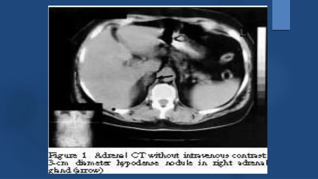 slide14