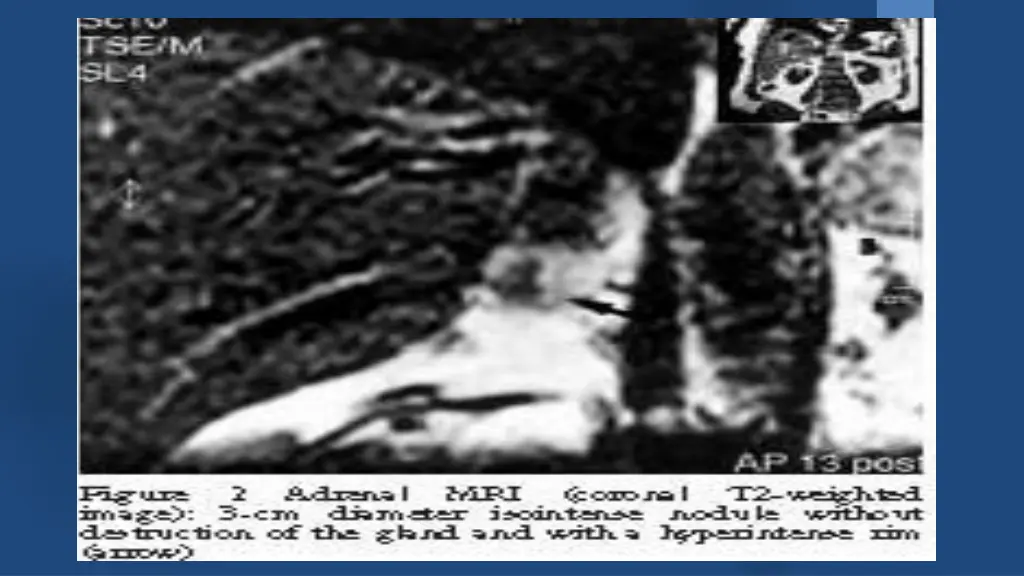 slide15