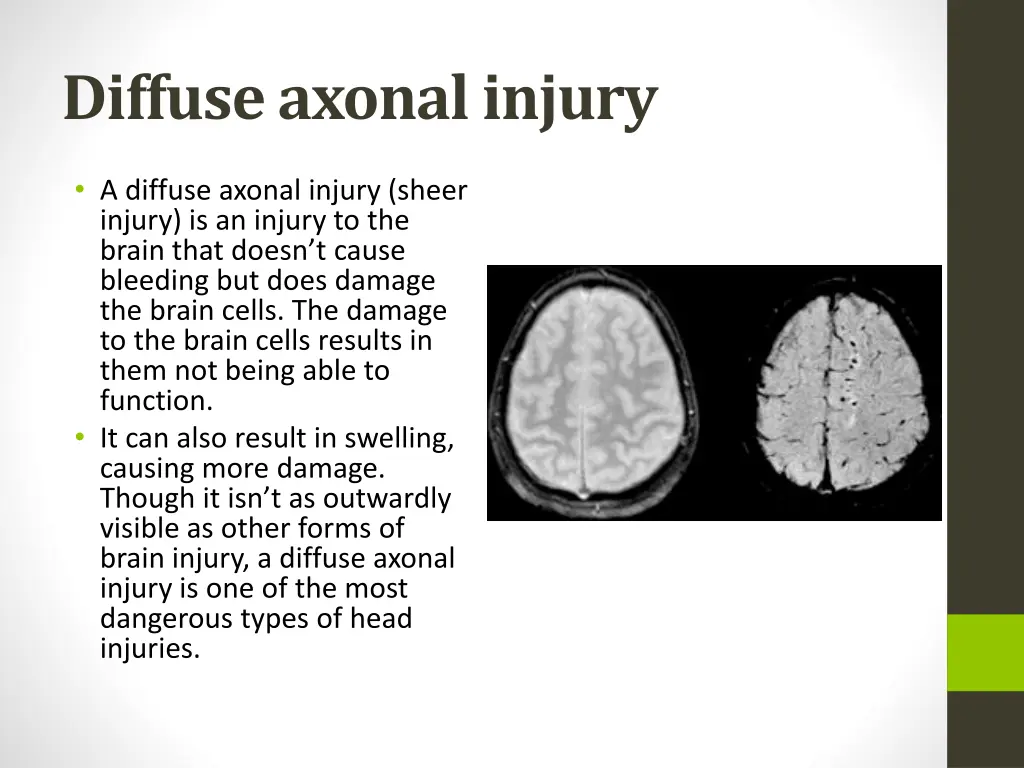 diffuse axonal injury