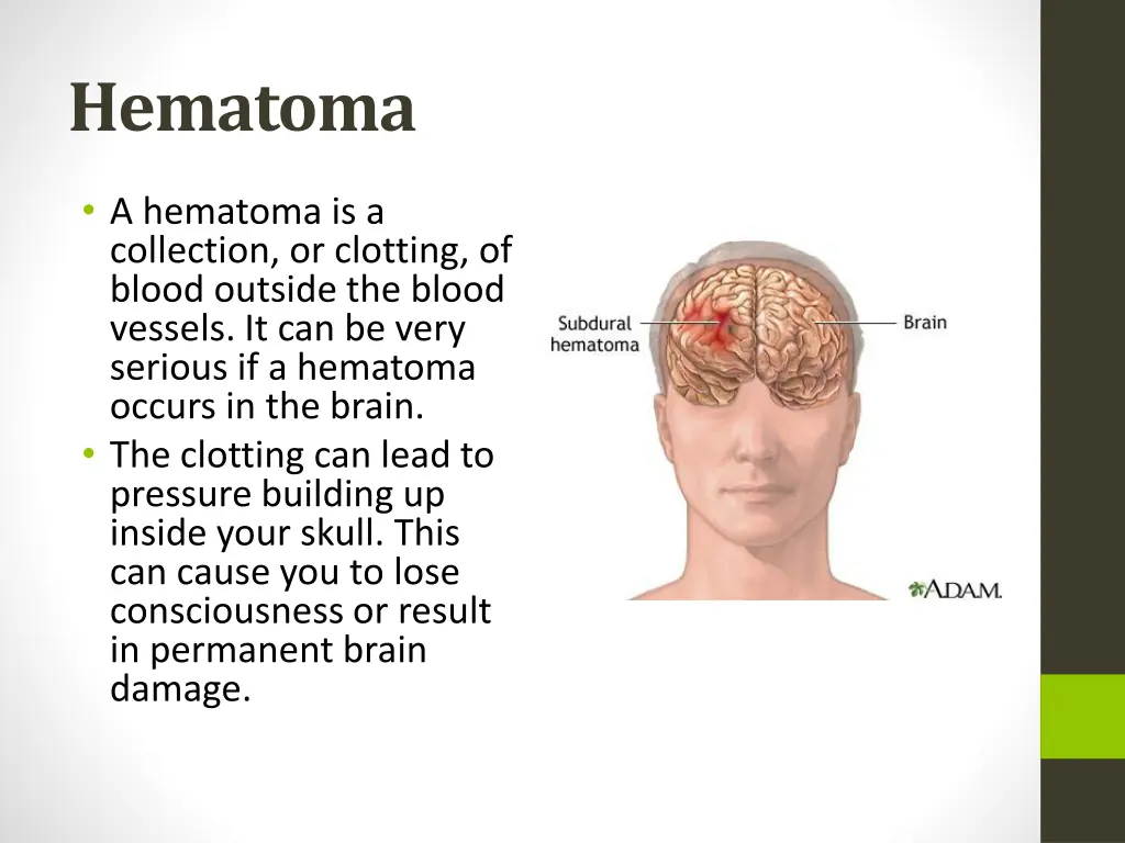 hematoma