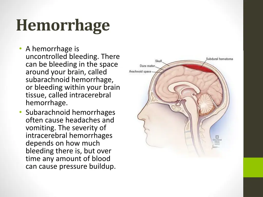 hemorrhage