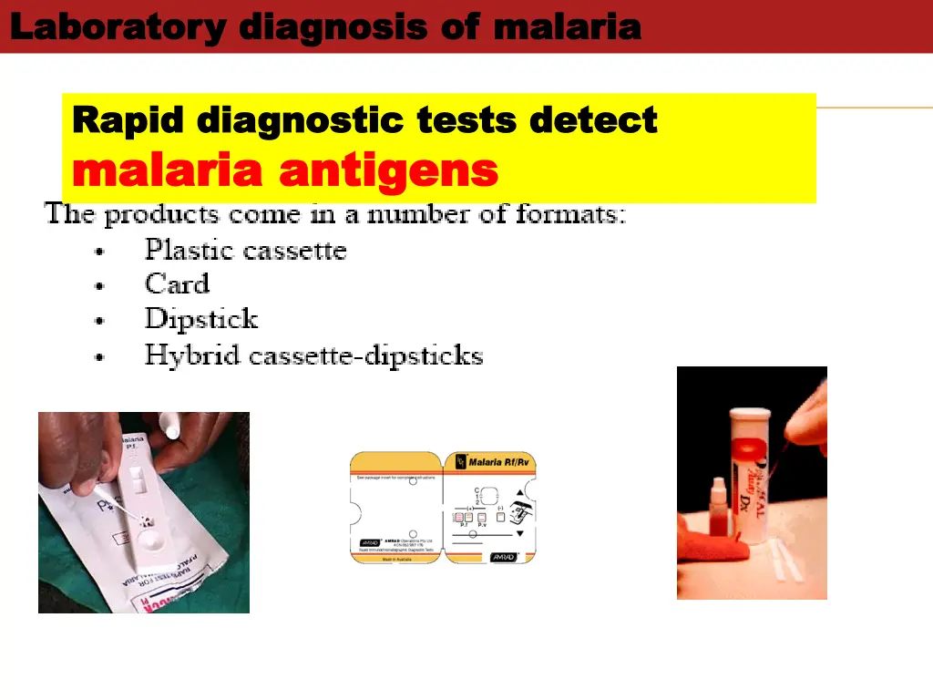laboratory diagnosis of malaria laboratory