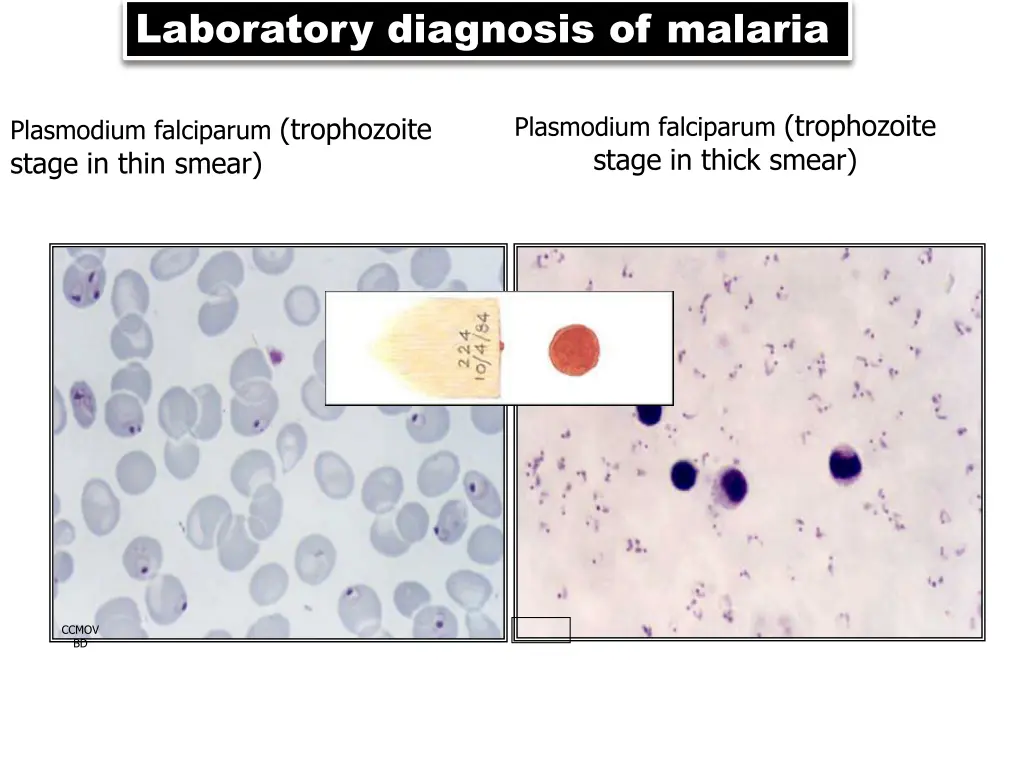 laboratory diagnosis of malaria
