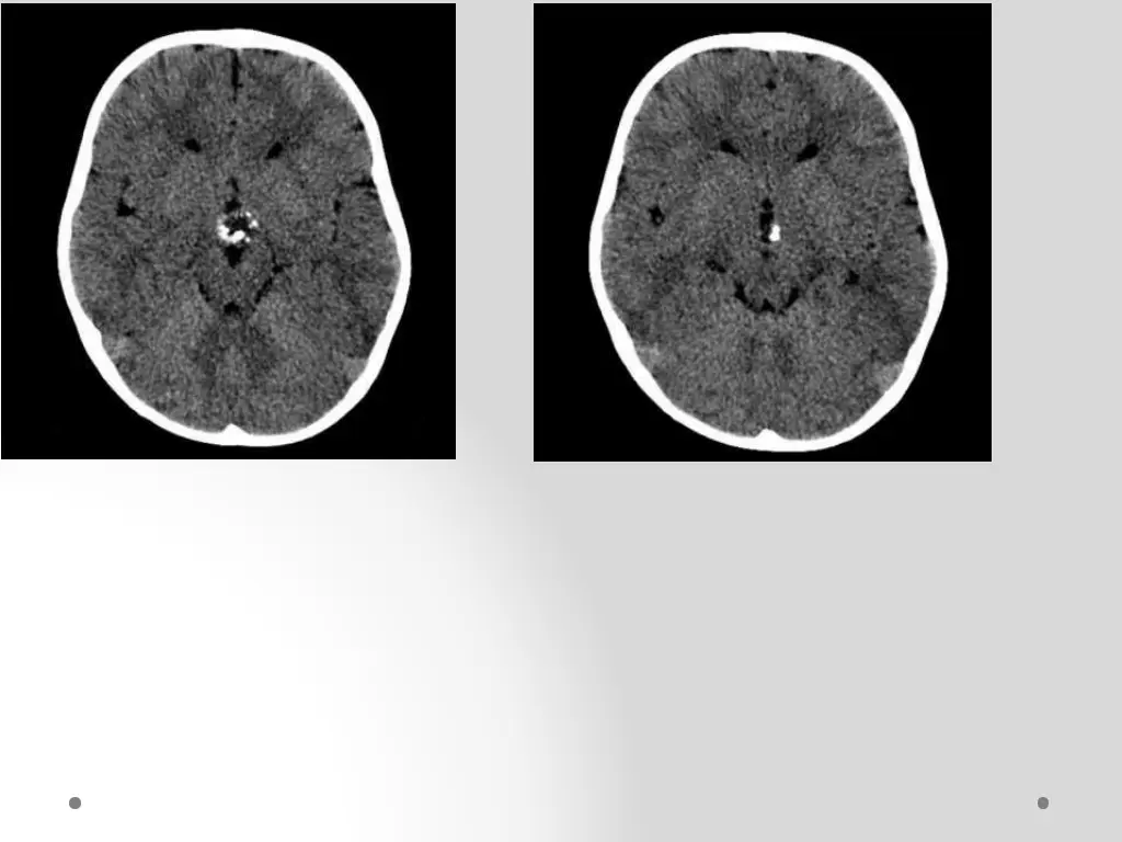 slide11