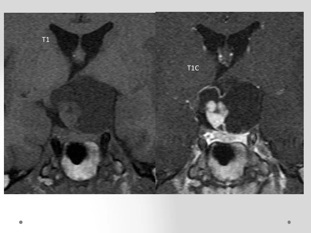 slide14