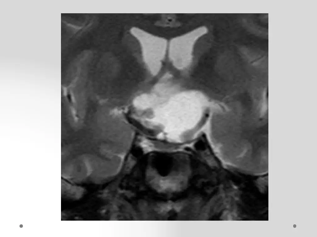 slide15