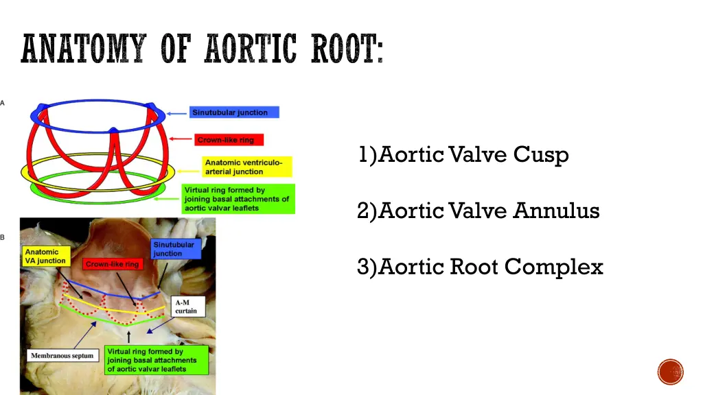 anatomy of aortic root