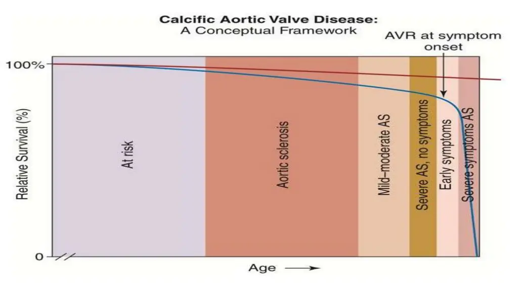 slide18