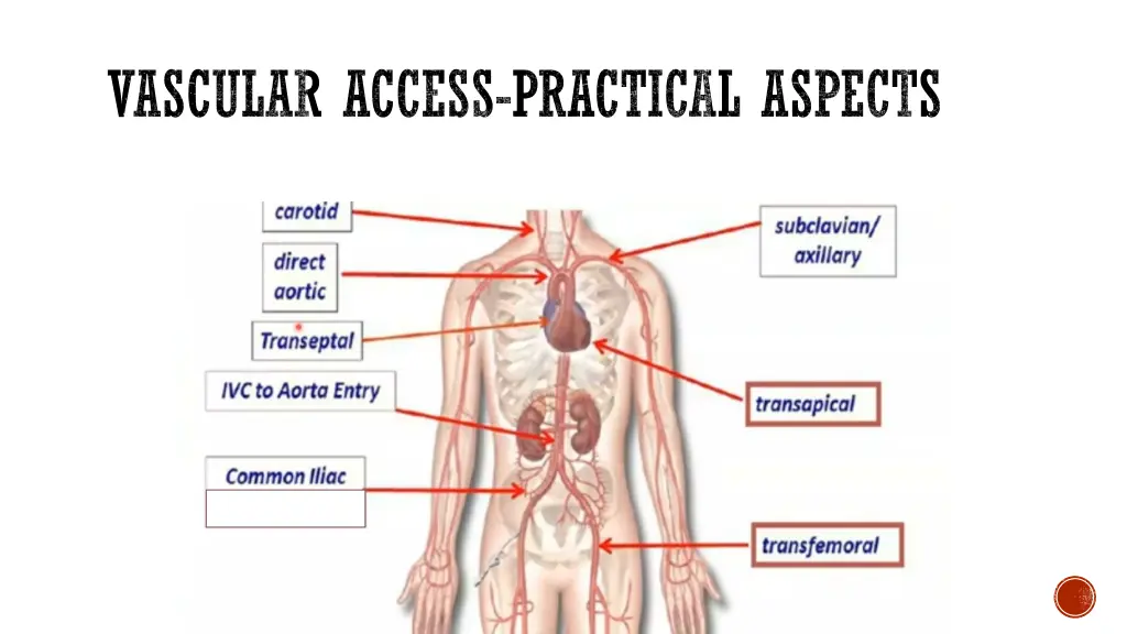 vascular access practical aspects