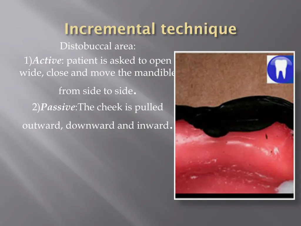 incremental technique distobuccal area 1 active