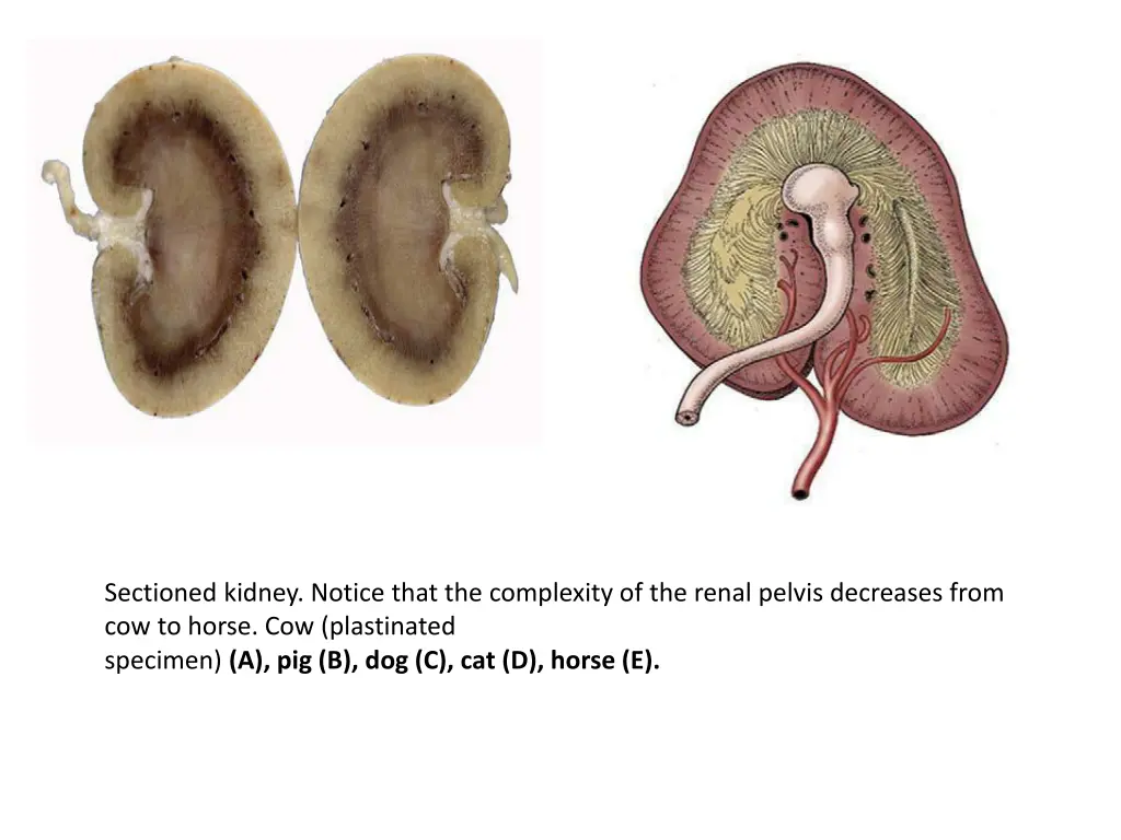 sectioned kidney notice that the complexity