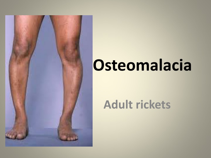 osteomalacia