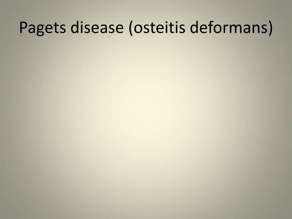 pagets disease osteitis deformans