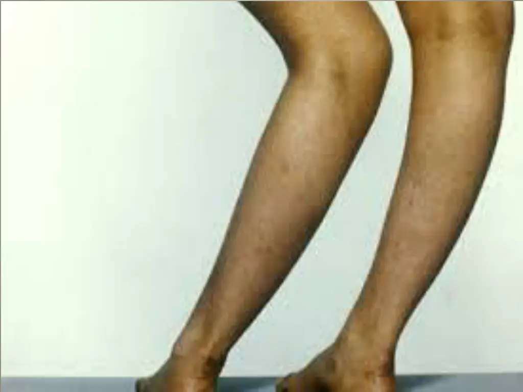 slide9