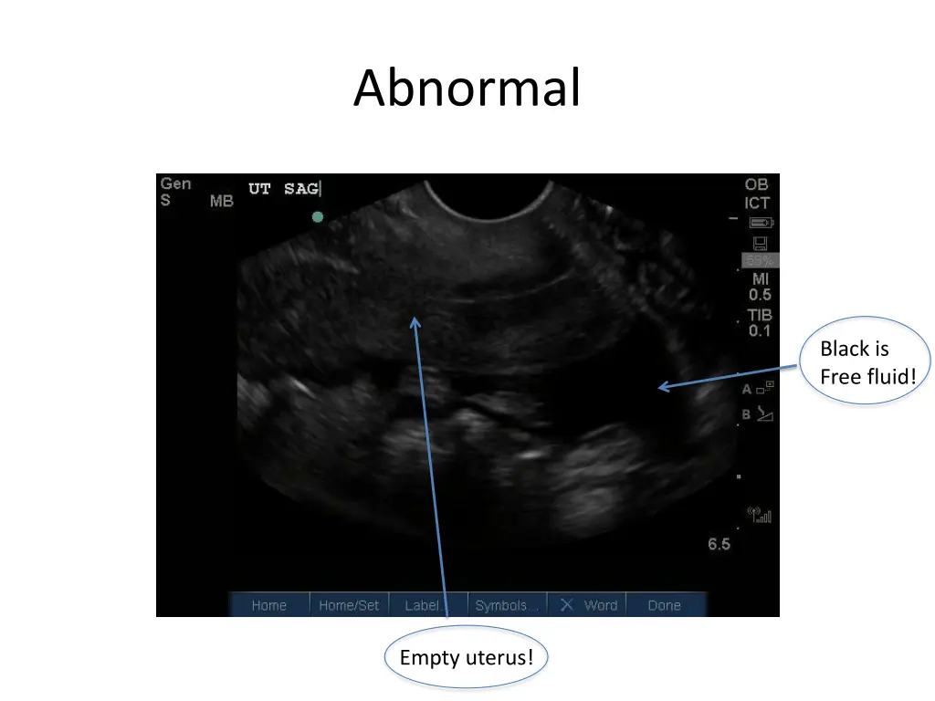 abnormal 1