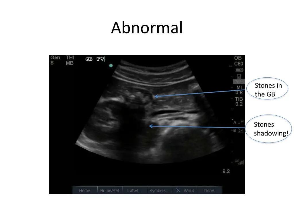 abnormal 5