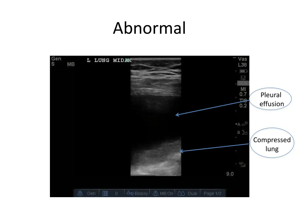 abnormal 7