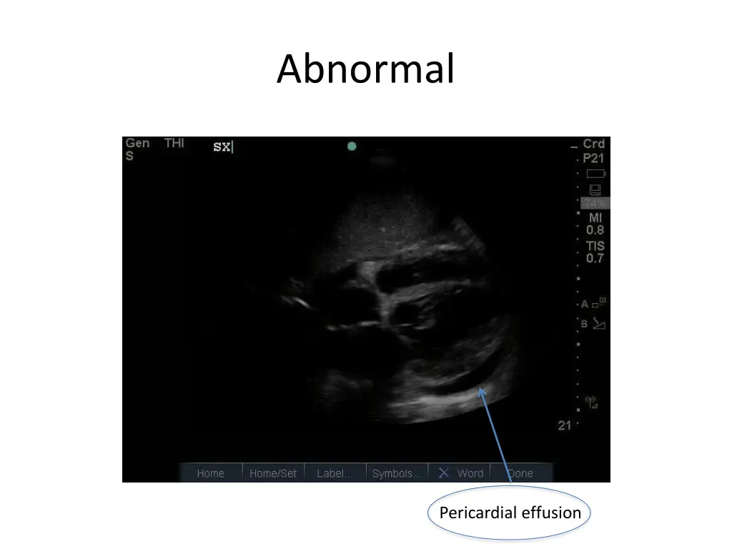 abnormal 8