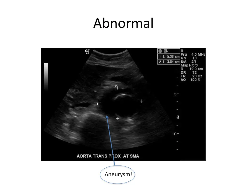 abnormal