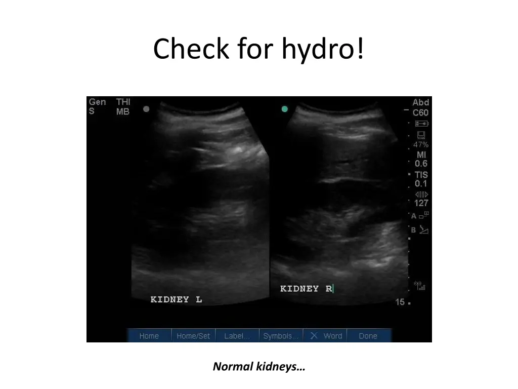 check for hydro